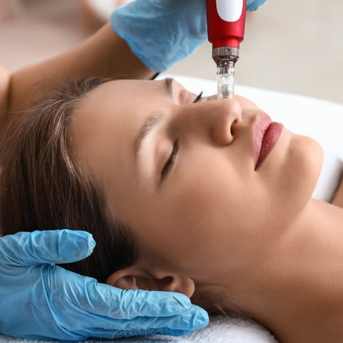 Microneedling